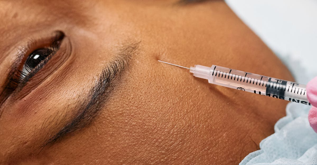 Timing Your Next Botox Appointment for Best Results