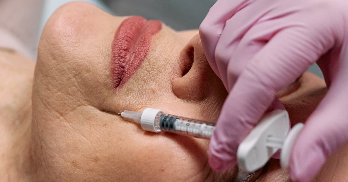 Understanding Botox for Chin Dimples and Gummy Smiles